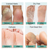 Foot Hard Dead Skin Remover HESAXY